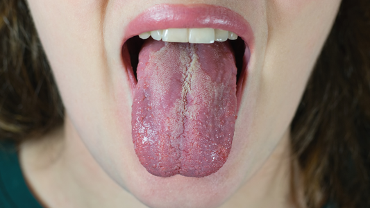 How to Use Castor Oil for Candida: A Natural Remedy That Works!