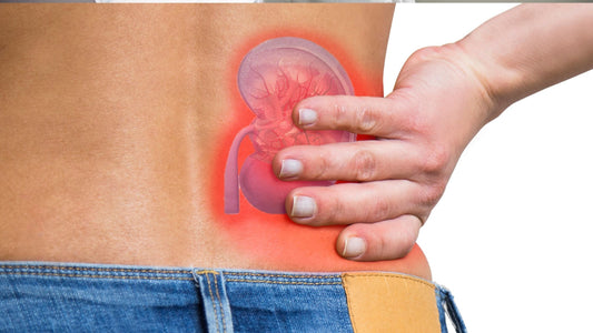 Can Castor Oil Help with Kidney Stones? A Natural Approach to Relief.